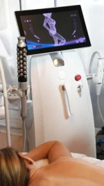 10x tselluliidiravi VelaShape Platinumiga - Image 2