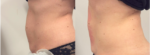 Trinity® Express Belly Burn & Tone - Image 3