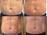 Trinity® Express Belly Burn & Tone
