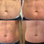 Trinity® Express Belly Burn & Tone
