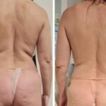 Trinity® Vibe & Slim: Back Edition – 5-korra Intensiivkuur
